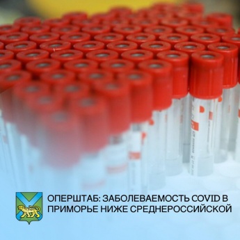 За прошедшие сутки COVID-19 диагностирован еще у 91 жителя региона. Общее количество заболевших с начала эпидемии составило 8 348 человек.