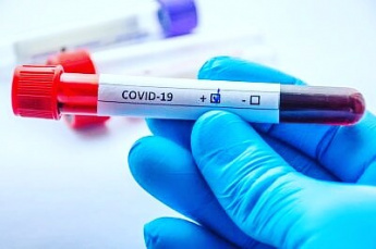 Статистика о заболевших COVID-19 на 15 декабря
